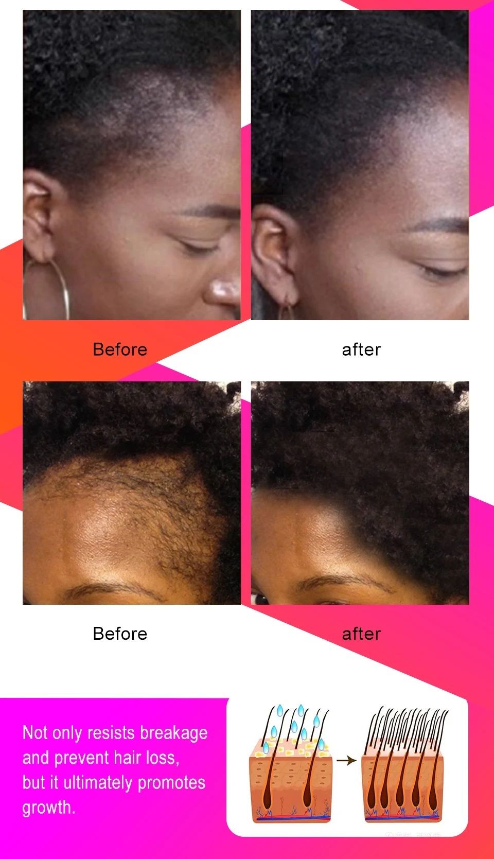 Fast Hair Growth Set Chebe Oil Traction Alopecia Hair Mask Anti Break Loss Hair Growth Oil Baldness Treatment Hair Care Products