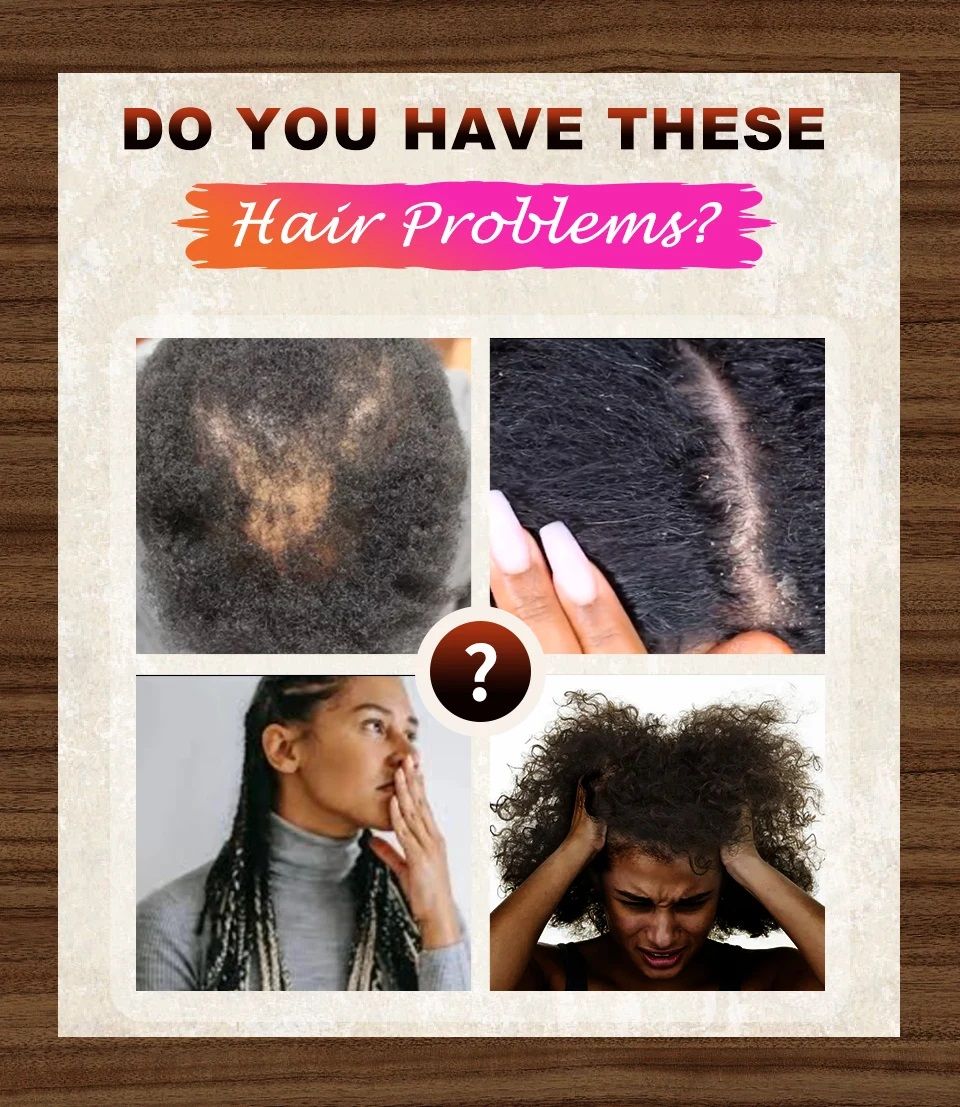 Fast Hair Growth Set Chebe Oil Traction Alopecia Hair Mask Anti Break Loss Hair Growth Oil Baldness Treatment Hair Care Products