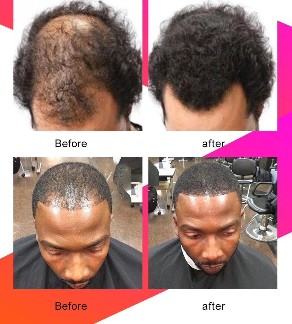 Fast Hair Growth Set Chebe Oil Traction Alopecia Hair Mask Anti Break Loss Hair Growth Oil Baldness Treatment Hair Care Products