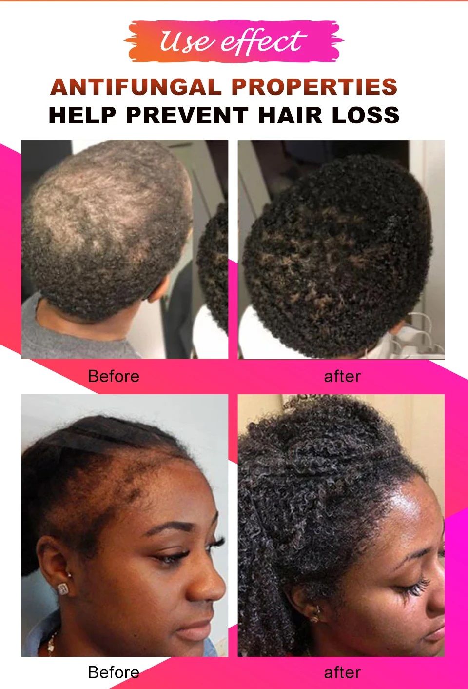 Fast Hair Growth Set Chebe Oil Traction Alopecia Hair Mask Anti Break Loss Hair Growth Oil Baldness Treatment Hair Care Products