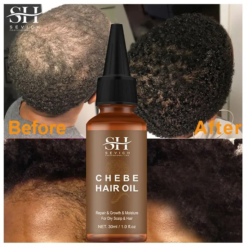 Fast Hair Growth Set Chebe Oil Traction Alopecia Hair Mask Anti Break Loss Hair Growth Oil Baldness Treatment Hair Care Products