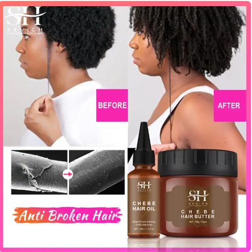 Africa Traction Alopecia Hair Growth Oil 100g Anti-break Moisturize Hair Fast Hair Growth Product African Crazy Traction Alopecia Hair Oil Anti Hair Break Hair Strengthen Hair Loss Treatment Care