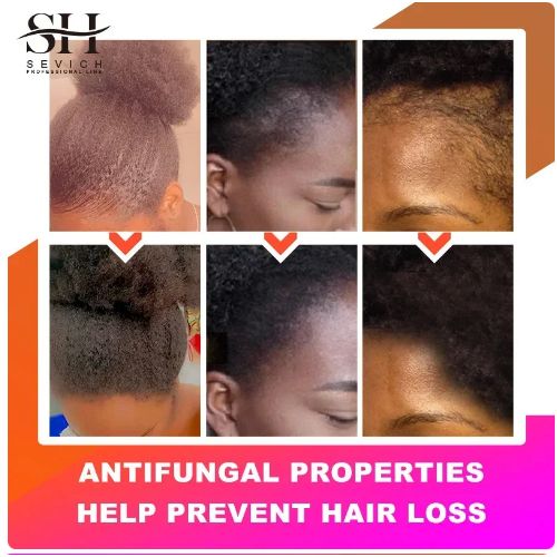 Africa Traction Alopecia Hair Growth Oil 100g Anti-break Moisturize Hair Fast Hair Growth Product African Crazy Traction Alopecia Hair Oil Anti Hair Break Hair Strengthen Hair Loss Treatment Care