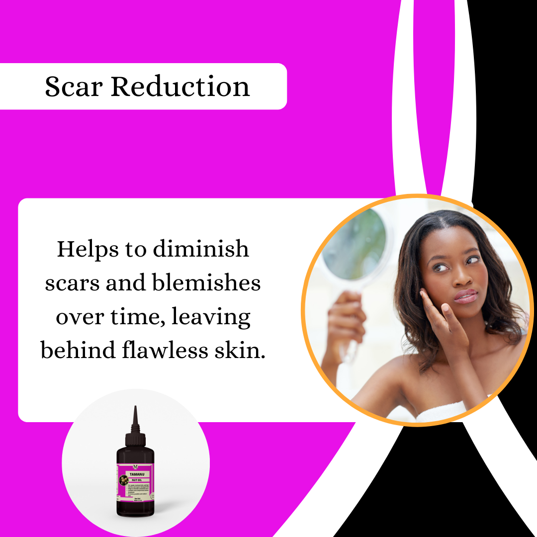 Tamanu Oil -For  Scar Reduction, Acne Fighter, Anti-Aging & Stimulates Hair Growth