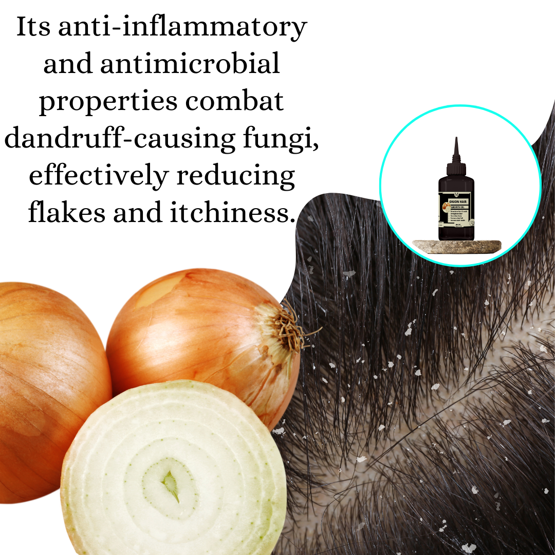 Onion Hair Growth Oil -100% Pure,Stimulates Hair Growth,Strengthens Hair,Nourishes Scalp,Prevents Hair Fall.