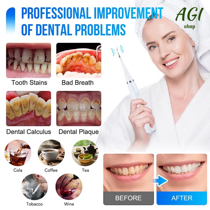 Electric Toothbrush Sonic Dental Teeth Whitening Kit Tooth Whitener Calculus Tartar Remover Tools Cleaner Stain Oral Care, Whitening Instrument Waterproof USB Fast Charging Device For Dental Brush