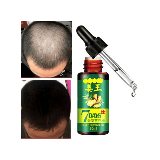 Aichun Beauty Hair Growth Serum  Men&Women- 7days Tonic Ginger Germinal Oil
