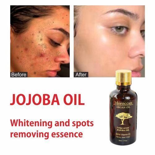 Moroccan Argan Oil Triple Vitamin Booster Serum -  With Organic Jojoba Oil, Vitamin C, E & F - Fades Stubborn Dark Spots, Acnes, Scares, Sun spots and Blemishes