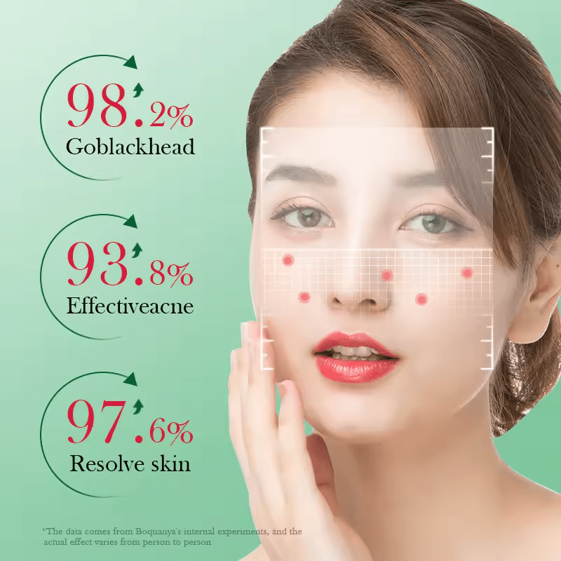 5 Pieces Acne Treatment Face Mask, Acne Removal Face Mask, Regulates Oil Secretion, Acne removal, Fades Acne Marks, Shrink Pores, Moisturize, Can Use Vitamin C afterwards For a Pure Supple Skin