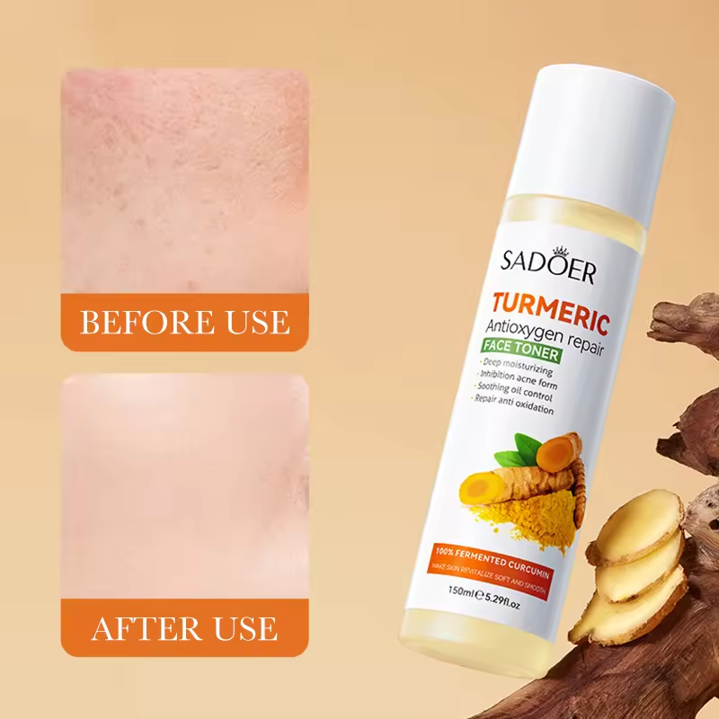 Sadoer Turmeric Face Toner, Tumeric Face Toner Anti Oxygen Repair Toner for Deep Moisturizing Akin to Vitamin C, Prevent Acne Formation, Oiil Control, Soothing, Repair and Anti Oxidation, Rejuvenate