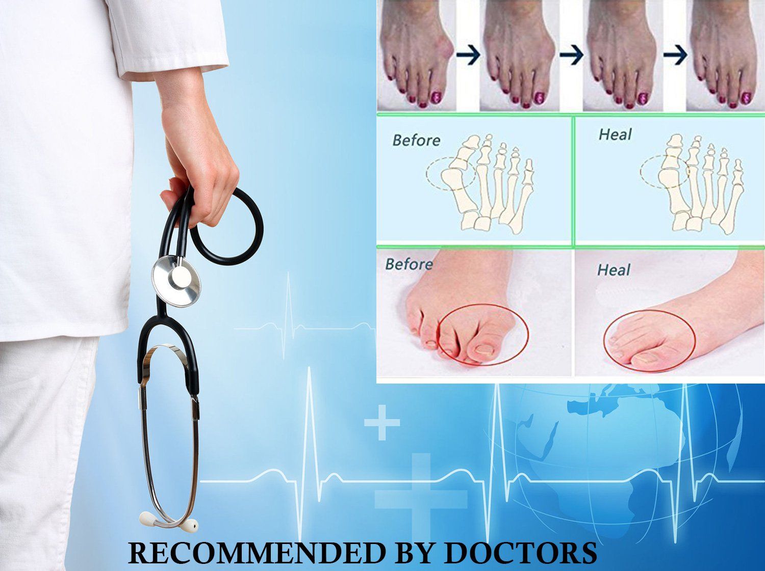 2PCS Gel Toe Separator, Toe Straightener, Toe Spacers， New Material, Hammer Toe Straightener for Relaxing Toes, Hammer Toe, Great for Women and Men