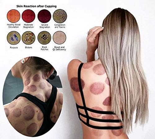 Cupping Set Professional Chinese Acupoint Cupping Therapy Sets Portable, Suction Hijama Cupping Set with Vacuum Magnetic Pump Cellulite Cupping Massage Kit