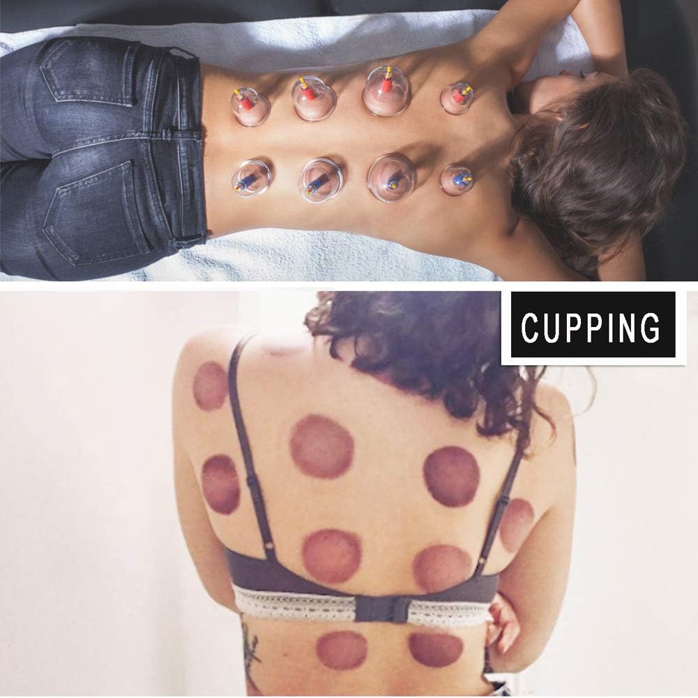 Cupping Set Professional Chinese Acupoint Cupping Therapy Sets Portable, Suction Hijama Cupping Set with Vacuum Magnetic Pump Cellulite Cupping Massage Kit