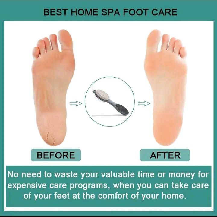 2 Pcs 4 In 1 Foot Scrubber Pedicure Tool, Contains Pumice Stone, Cleansing Brush, Metal File and Buffing File