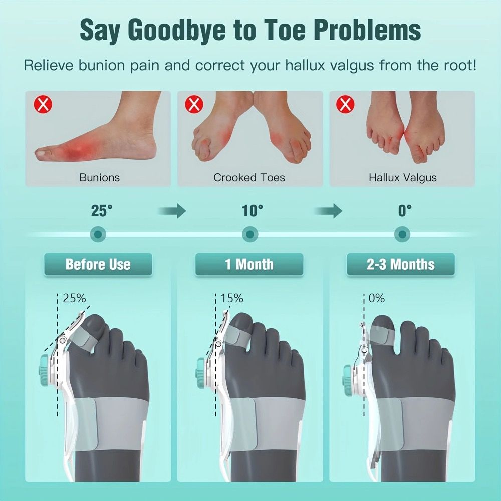 Bunion Corrector for Women Men Big Toe, Adjustable Knob Bunion Splint for Bunion Relief, Orthopedic Toe Straightener with Anti-slip Heel Strap, Suitable for Left and Right Feet (1PC)
