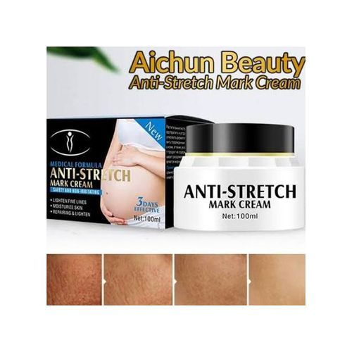 Aichun Beauty Medical Formula Anti-Stretch Mark Cream.