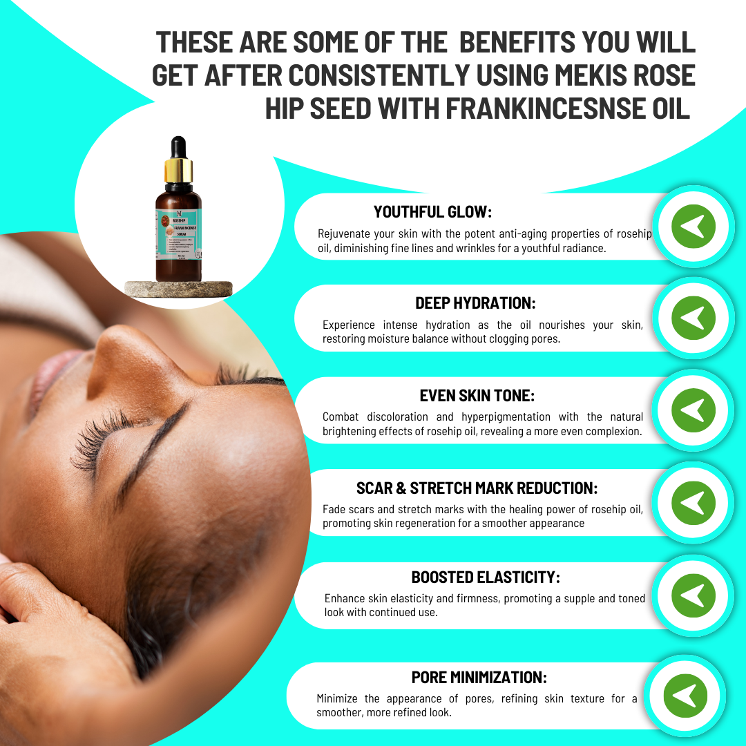 Rosehip Frankincense Serum- Potent anti-aging,Youthful Radiance, Combat Discoloration & Hyperpigmentation