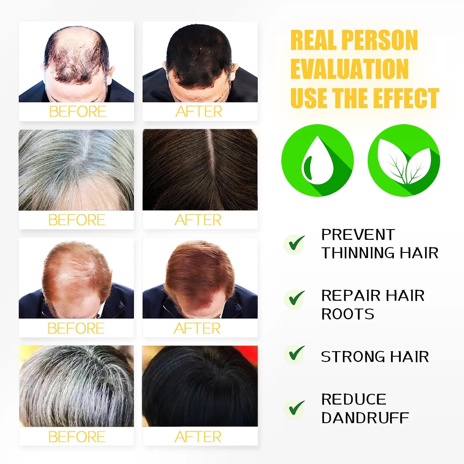 10 pcs HERBAL HAIR TREATMENT SHAMPOO BAG Moisturizing  Cleaning Care Herbal Hair Shampoo Bag Ginger Extract Natural Hair Darkening Repair Strong Hair Root Moisturizer Hair Cleaning Treatment