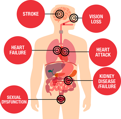 Cardioton Capsules To Help Control Blood Pressure In The Body