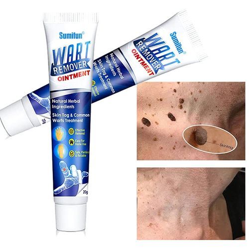 Sumifun Wart Remover Ointment Cream 20g