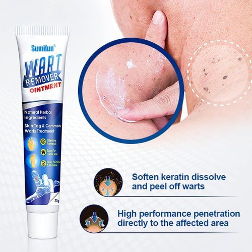 Sumifun Wart Remover Ointment Cream 20g