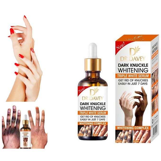 Dr Davey Whitening Serum For Dark Knuckles,Elbows,Thighs,Knees & Darkspots Brightens & Smoothens Skin