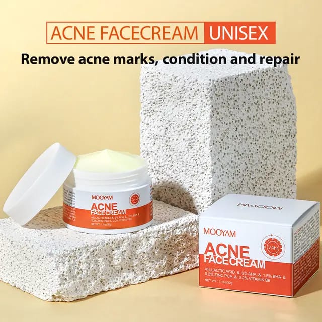 ACNE  FACE REMOVAL CREAM FAST VEGAN  EFFECTIVE FACE CARE CLEARS ACNE AND BLACK HEADS LACTIC ACID INFUSED MOISTURIZER FIRMING CREAM SHRINKS PORES NOURISHES SKIN SKIN REVITALIZER