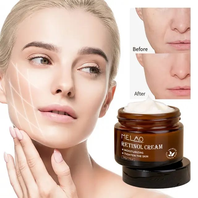 IREV RETINOL FACE  and  EYE CREAM MOISTURIZING SMOOTH ANTI -AGING ANT- WRINKLES REPAIRING DARK CIRCLES LIGHTENS EYE LINES AND BRIGHTENS THE SKIN TONE