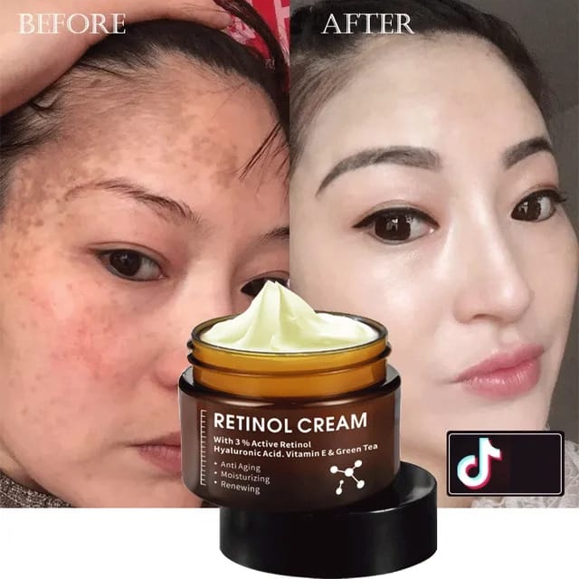 IREV RETINOL FACE  and  EYE CREAM MOISTURIZING SMOOTH ANTI -AGING ANT- WRINKLES REPAIRING DARK CIRCLES LIGHTENS EYE LINES AND BRIGHTENS THE SKIN TONE