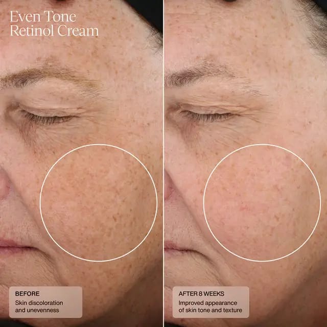 IREV RETINOL FACE  and  EYE CREAM MOISTURIZING SMOOTH ANTI -AGING ANT- WRINKLES REPAIRING DARK CIRCLES LIGHTENS EYE LINES AND BRIGHTENS THE SKIN TONE
