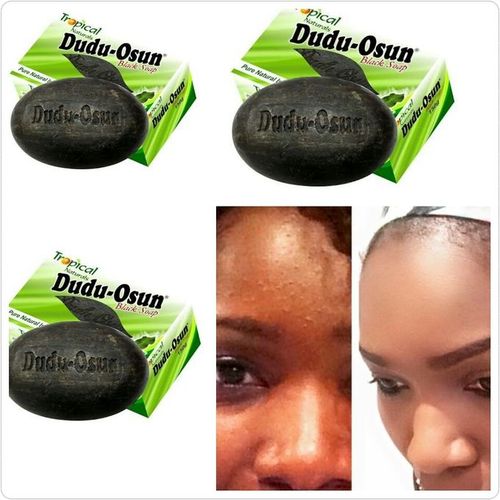 Tropical naturals dudu osum 3 pcs soaps