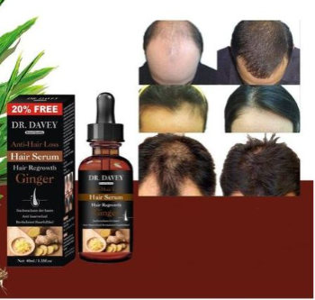 DR. DAVEY Anti-Hair Loss Hair Serum For Hair Regrowth Made with Ginger making it very effective.