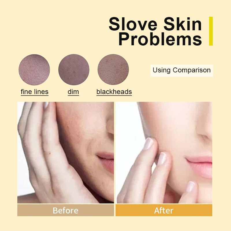 Turmeric skin care products set, moisturizing water repair water moisturizing skin care products