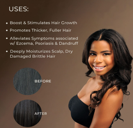 Sunny Isle Jamaican Black Castor Oil 100% Natural Treatment for Hair, Scalp and Skin