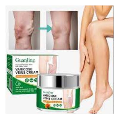 Guanjing Varicose Vein Cream Spider Varicose Vein Cream 50g
