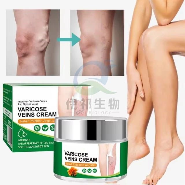 Varicose Veins Cream Quickly Absorption Non-greasy