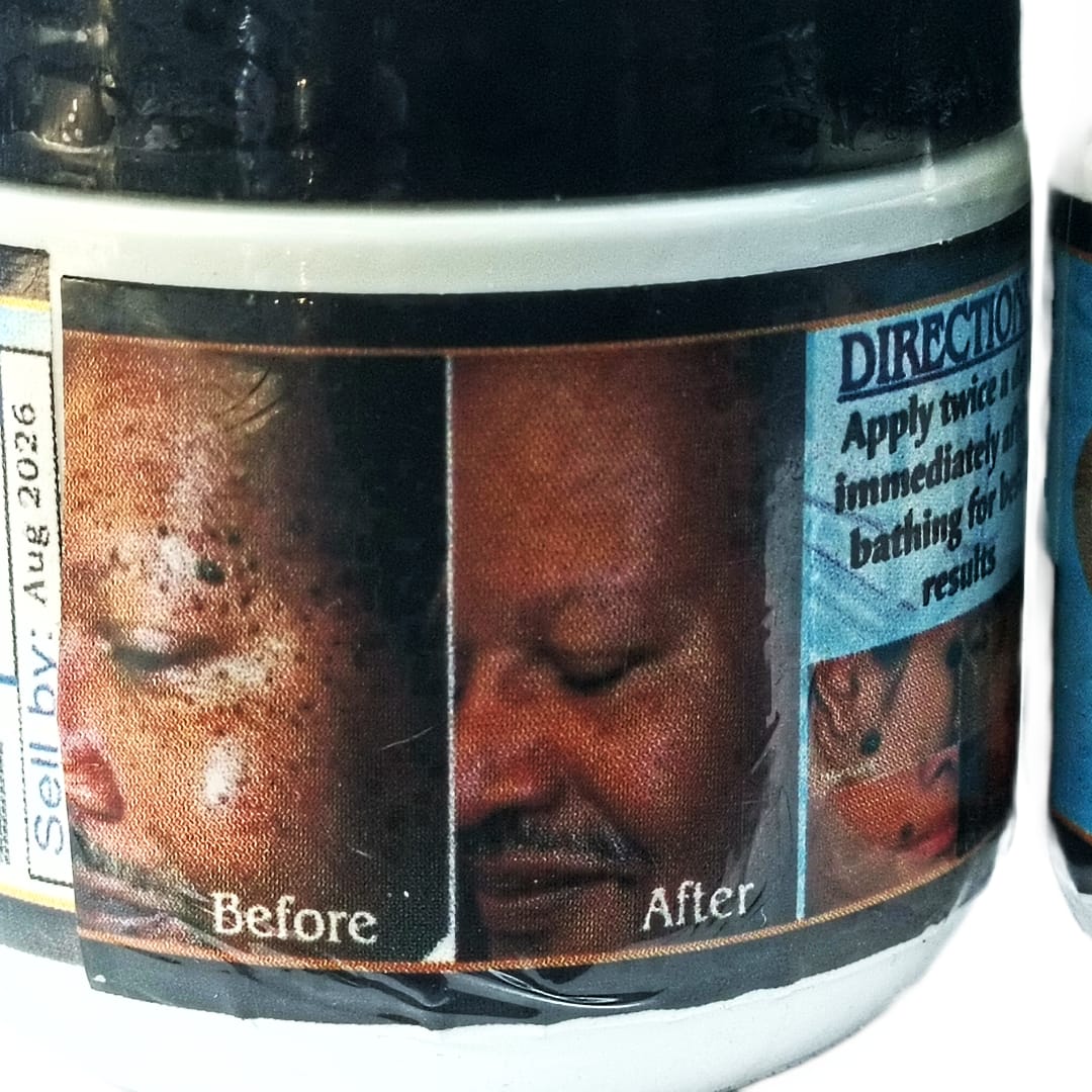 DISCOUNT!!SKIN TAG REMOVER/ MAGIC WARTS removal cream Removes Spots And Unwanted Skin Flaws