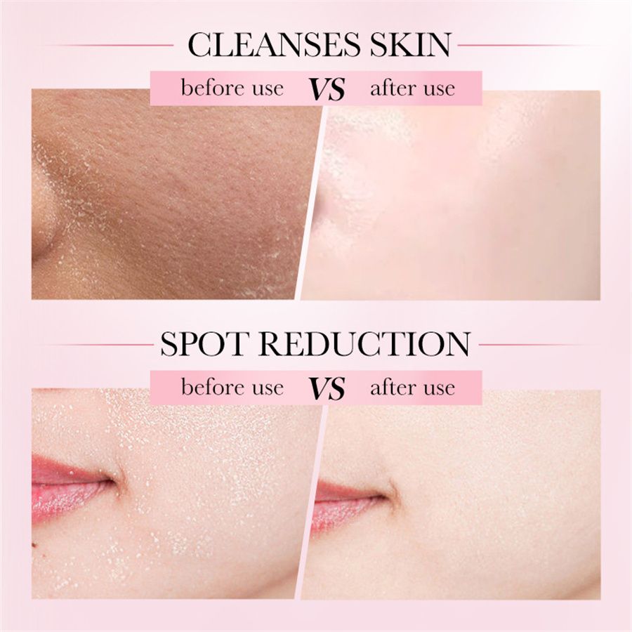 2pcs   Facial Multi-Effect Cleansing Mousse Cleansing Foam cleanser 150ML+ Face Essence Original Serum niacinamide Vitamin C Vitamin E Serum 30ML skin Care