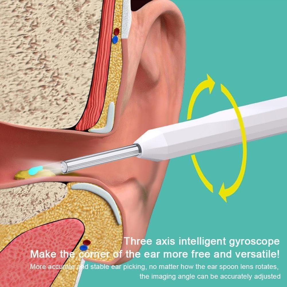 Smart Camera Wireless Ear Cleaner NE16 Wi-Fi Wax Remover HD Earwax Cleaning Stick for iPhone Android Visual Endoscope
