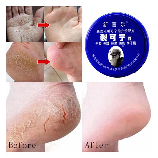 Anti Crack Foot Cream Dryness Foot Mask Heel Cracked Repair Cream Hand Moisturizing Removal Callus Dead Skin Hands Feet Care 4.5