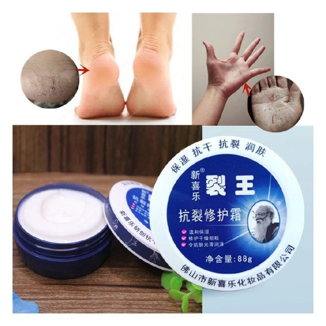 Anti-Crack Repair Cream 88g Moisturizing Anti-Dry Hand, Foot and Heel Crack King Cream Face Cream