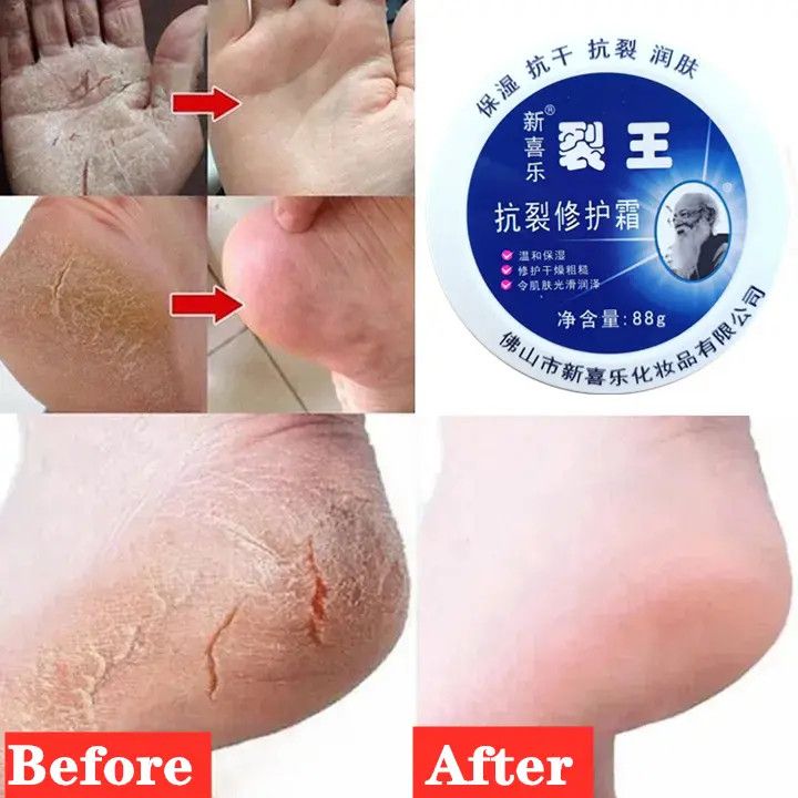 Anti Crack Foot Cream Dryness Foot Mask Heel Cracked Repair Cream Hand Mositurizing Removal Callus Dead Skin Hands Feet Care