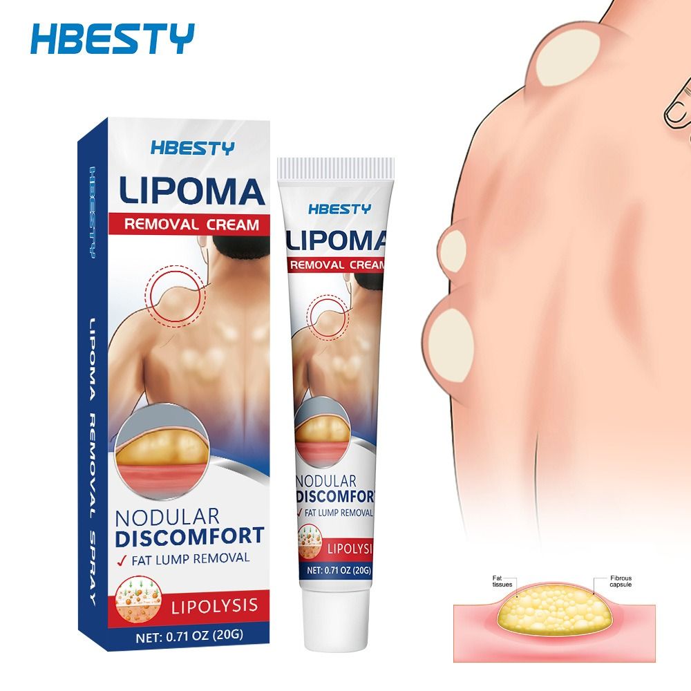 Fat Jie Xiao Gao relieve Fat caking Fat granules subcutaneous lump Protrusion Dispersal cream