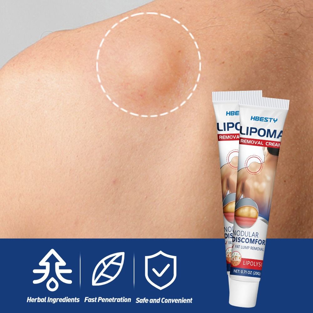 Fat Jie Xiao Gao relieve Fat caking Fat granules subcutaneous lump Protrusion Dispersal cream