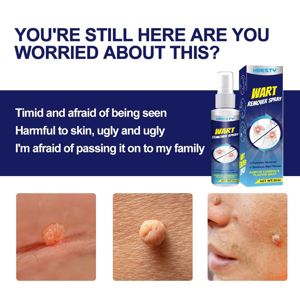 Wart removing spray Wart flat Nursing solution Chicken eye diced meat Fat granules Nursing repair fluid