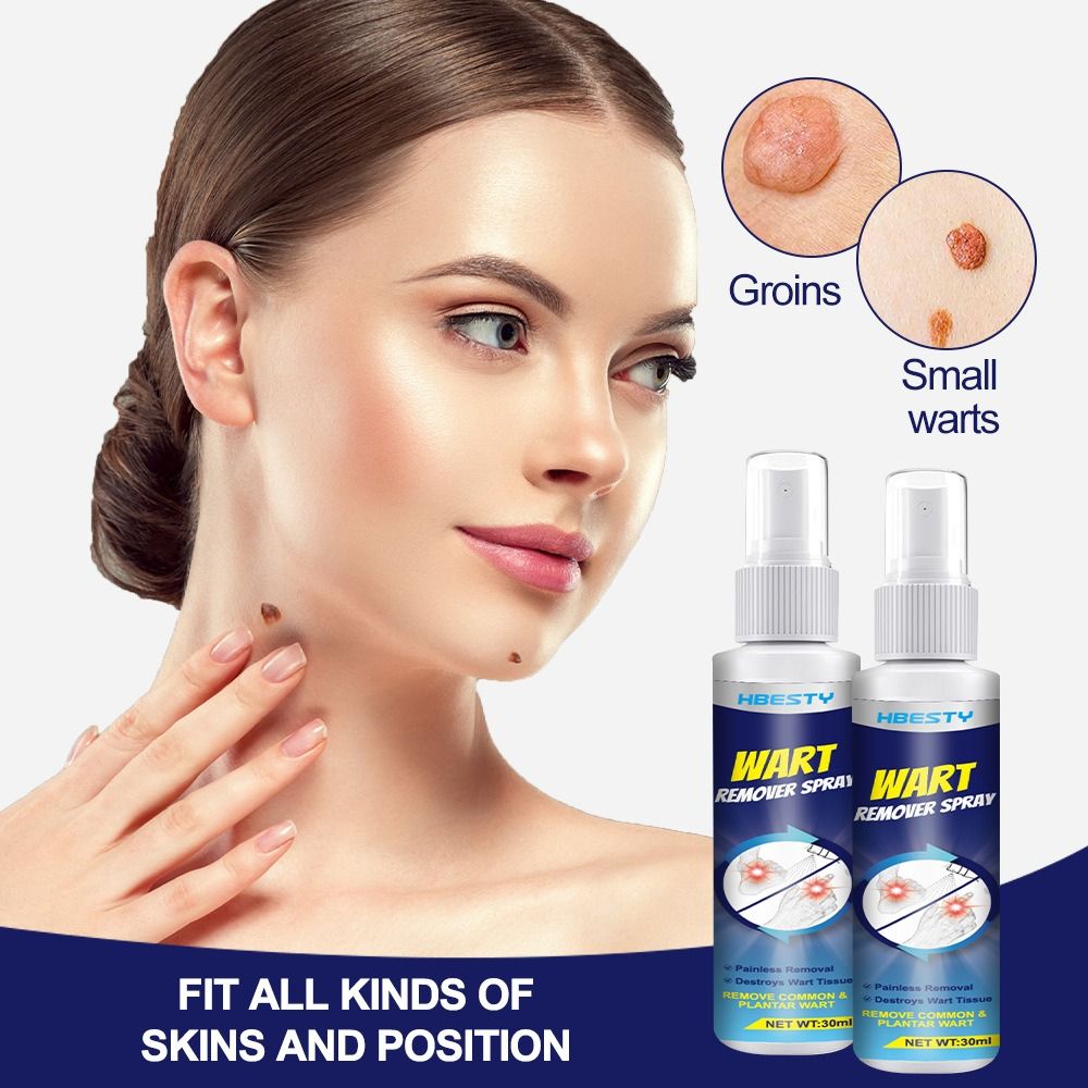 Wart removing spray Wart flat Nursing solution Chicken eye diced meat Fat granules Nursing repair fluid