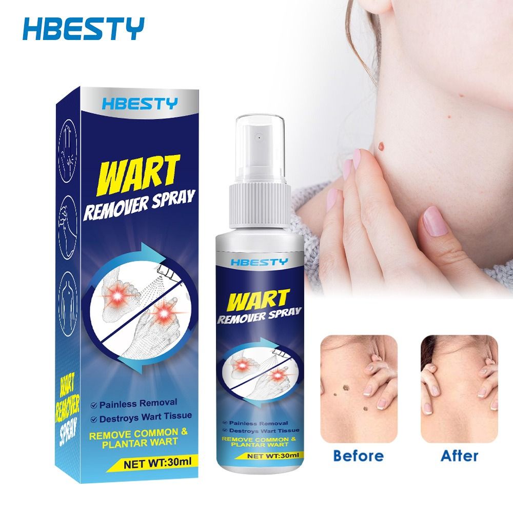 Wart removing spray Wart flat Nursing solution Chicken eye diced meat Fat granules Nursing repair fluid