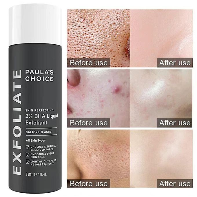 Paula's Choice Skin Perfecting 2% BHA Liquid Salicylic Acid Exfoliant - 118ml