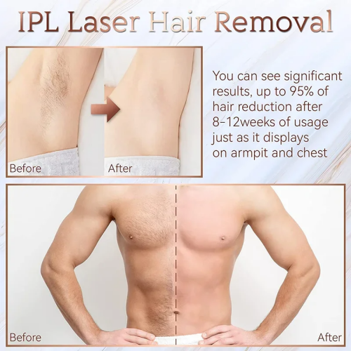 IPL Laser Epilator for Women Hair Trimmer Man Shaver Remover Mower Men's Electric Shaver Bikinis Razor GYM Hair Cutting Machine