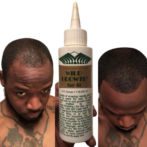 Wild Growth Hair Growth Oil